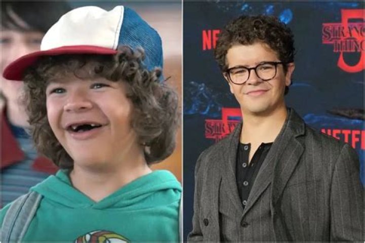 'Stranger Things' Star Gaten Matarazzo Underwent Multiple Teeth Surgeries