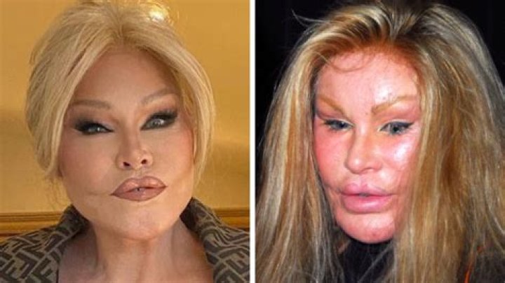Jocelyn Wildenstein Before Plastic Surgery: Her Look
